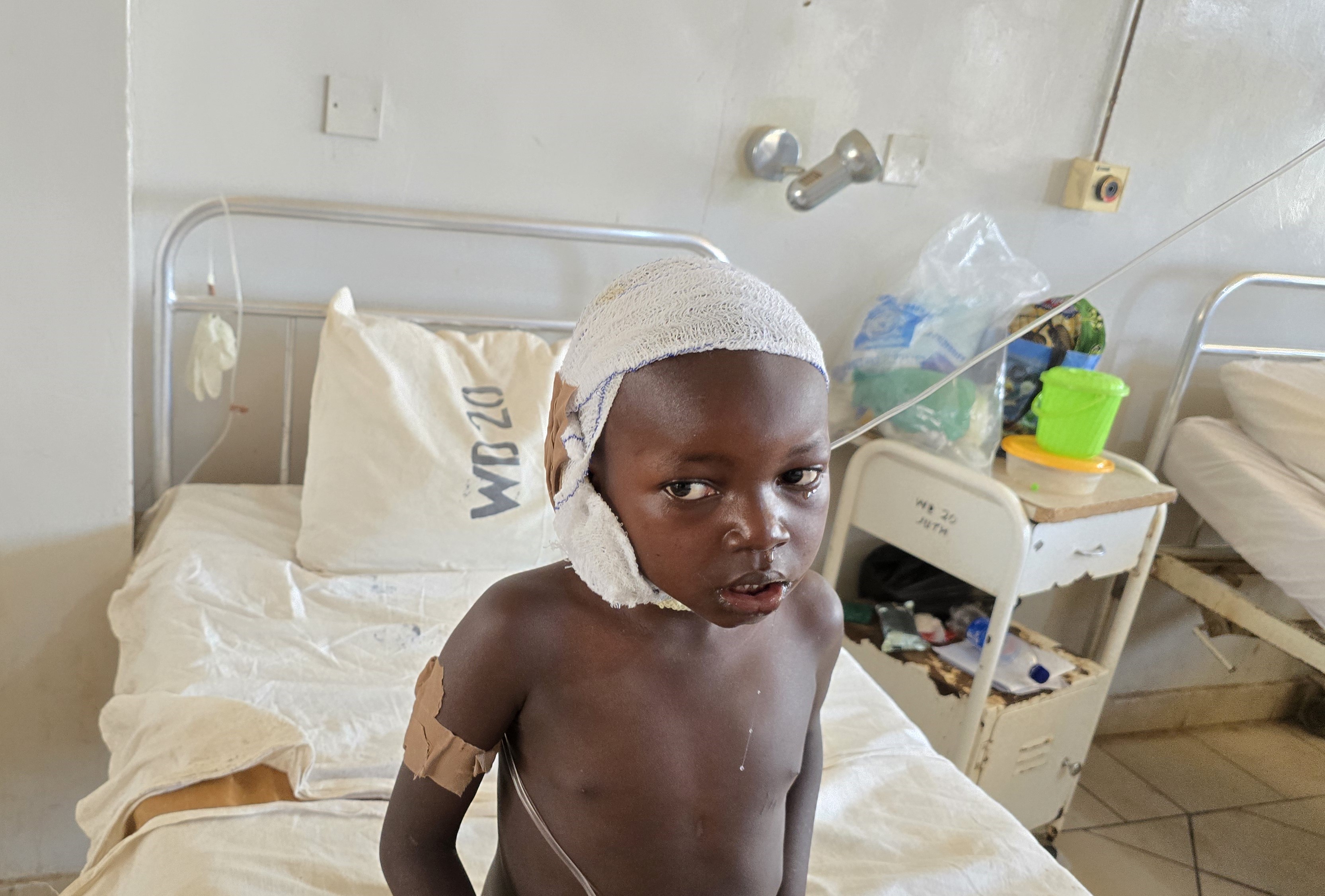 Nenche Steven, 7, was attacked with a machete in the Palm Sunday massacre. Most of his family was killed.