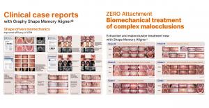 Text banners showcasing Graphy Shape Memory Aligner® clinical cases, emphasizing shape-driven biomechanics and zero-attachment solutions for complex malocclusions.