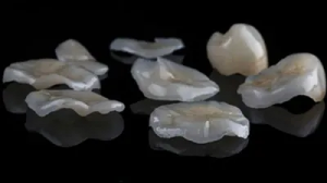 biomimetic-dentistry-in-westfield