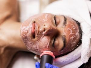 Oxygeneo Facial Before And After