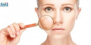 Hyperpigmentation Treatment Market