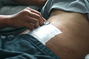 A surgical wound on the abdomen covered with a bioactive dressing for regenerative healing.