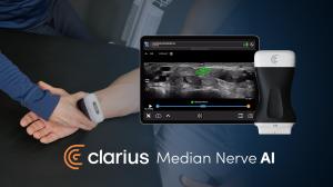 Ultrasound image of the wrist captured with the Clarius L15HD3 showing measurements by Clarius Median Nerve AI
