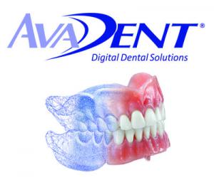 Avadent Digital Dentures