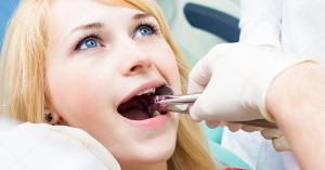 Emergency Tooth Extraction Reseda