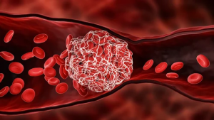 Hemophilia A Market Size
