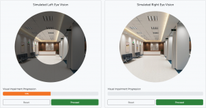Web-based glaucoma vision simulation on PC screen showing tunnel vision caused by visual field loss