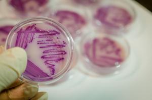 Acinetobacter baumannii