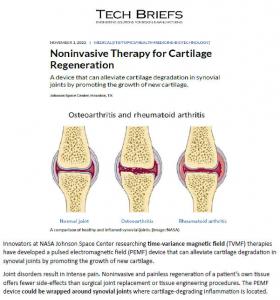 NASA Discovers Noninvasive Therapy for Cartilage Regeneration 2022