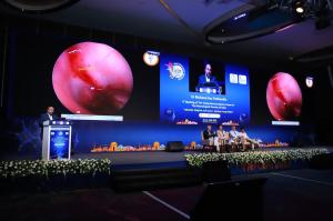 Dr. Mohana Rao Patibandla delivering a lecture on panventricular brain tumors at YNFNSICON 2025, with endoscopic third ventricle visuals displayed on a large screen and a panel of neurosurgical experts seated on stage.