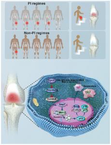 Link Between Premature Aging of Knee Joints and Acquired Immune Deficiency Syndrome (AIDS) Treatment