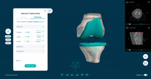 PeekMed Web Orthopedic Planning AI System