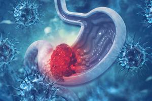 HER2+ Gastric Cancer Market