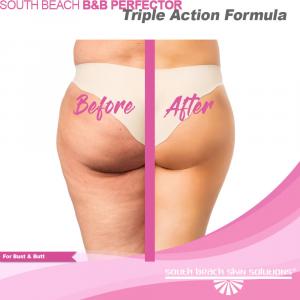 SB Bust & Butt Enhancing Gel Before and After