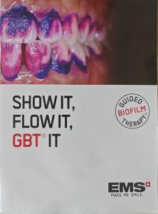 Close-up of teeth with disclosed biofilm showing Guided Biofilm Therapy (GBT) process for plaque detection and removal.