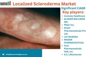 Localized Scleroderma Market