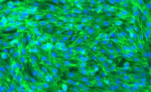 Angel's skin cells as seen through a microscope