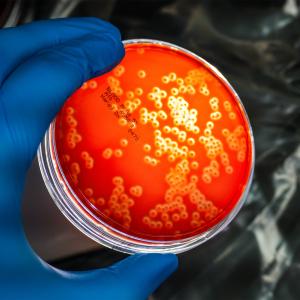 Pathogens contrived in Blood Agar