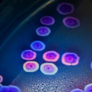 Photograph of Escherichia Coli | by Davron Bowman