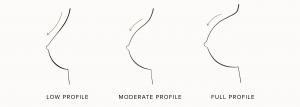 A diagram showcasing the differences in different types of breast implant profiles