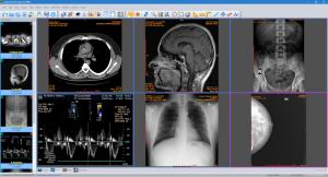 Medical Imaging Market
