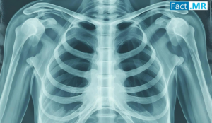 Smart Chest Patches Market