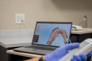 3D digital scan of a dental arc using iTero intraoral scanner for dental crowns at Mountainside dentist Dr. Jay A. Zimmerman, DMD