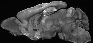 Black and white microscope image of a mouse brain slice