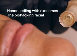 nanoneedling, exosomes, facial, skincare