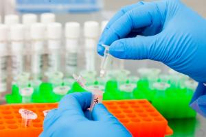 Nucleic Acid Extraction