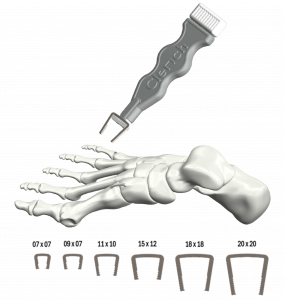 The Clench System is a fully disposable sterile fixation system