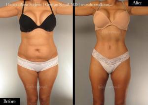 Dr. German Newall, Board Certified Plastic Surgeon