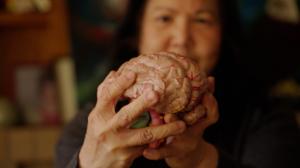 Dr. Fernette Eide studies a brain model thinking about differences in dyslexic brain structures.