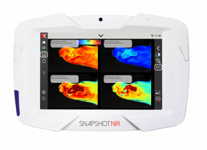 SnapshotNIR device with image of lateral foot on the screen with 4 panels showing color map of hemoglobin concentrations
