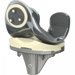 Cementless Cruciate Retaining System