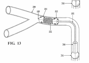 Diagram of Retriever Medical’s dual-sphere catheter system capturing a blood clot inside a vessel and preparing it for controlled extraction.