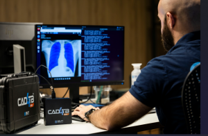 Delft Imaging CAD4TB solution - screening device for tuberculosis