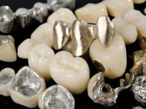 Dental Alloys Market, by Application
